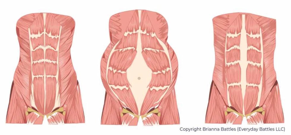 Your Remarkable, Resilient Postpartum Body